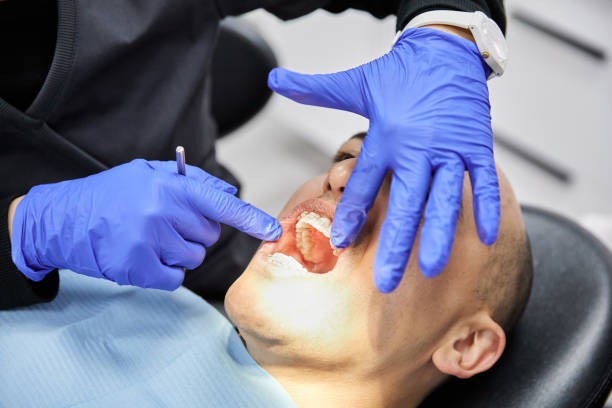 Best Broken or Chipped Tooth Repair in Battle Ground, IN